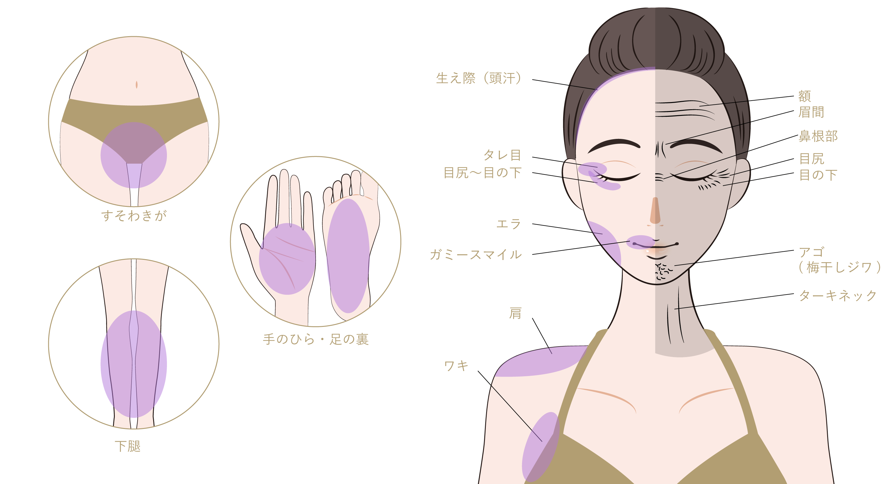 ボトックス