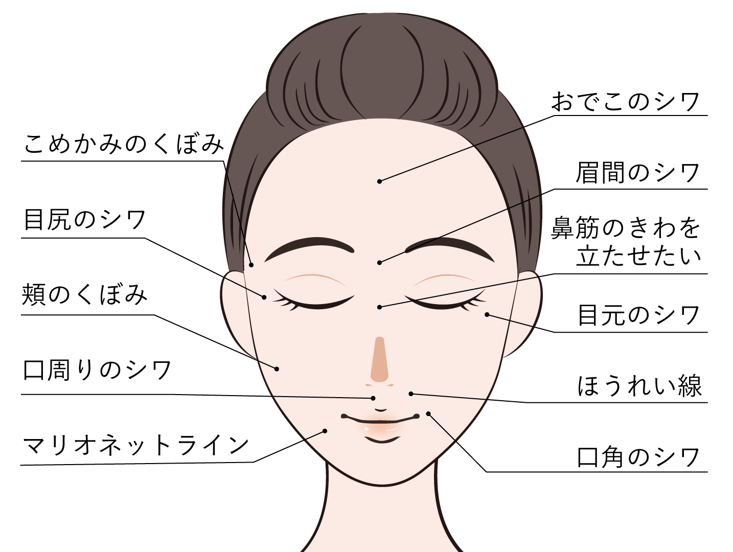 ヒアルロン酸注入 施術部位 エイジングケア ヒアルロン酸注入