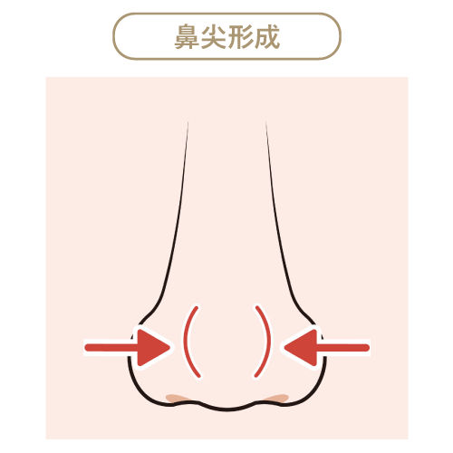 鼻尖形成 鼻尖形成